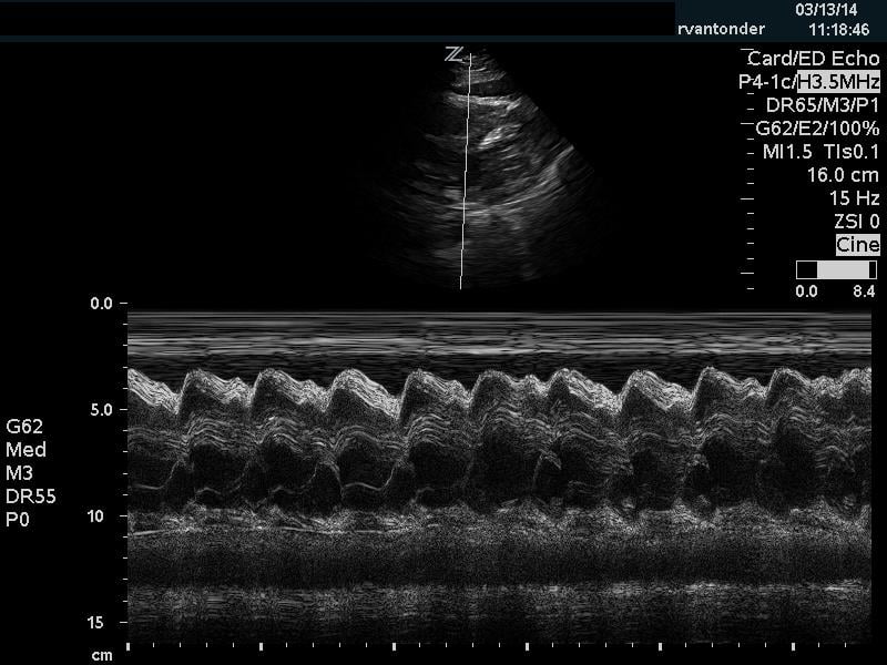 Sonoguide // Rapid Ultrasound for Shock and Hypotension (RUSH)