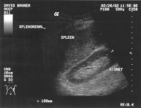 EM Ultrasound Section // Ultrasound Anatomy