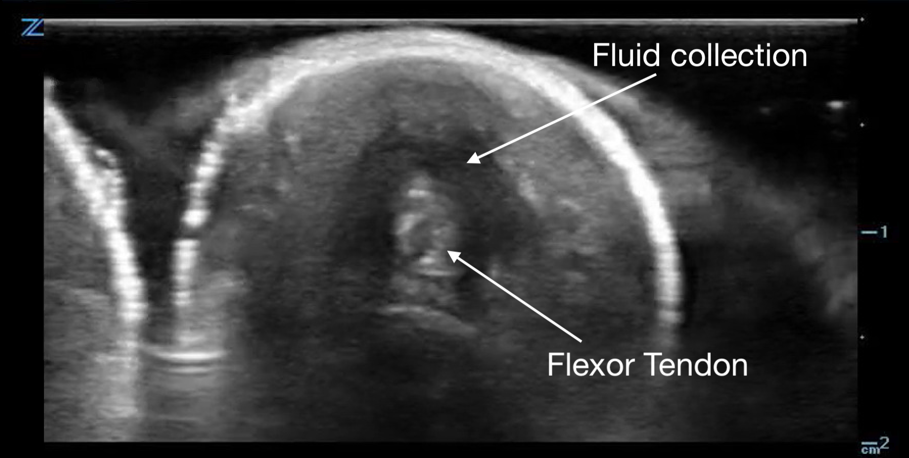 MSK-Figure 14a - FTS short.png