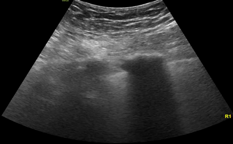 From the Chair | EM Ultrasound Section