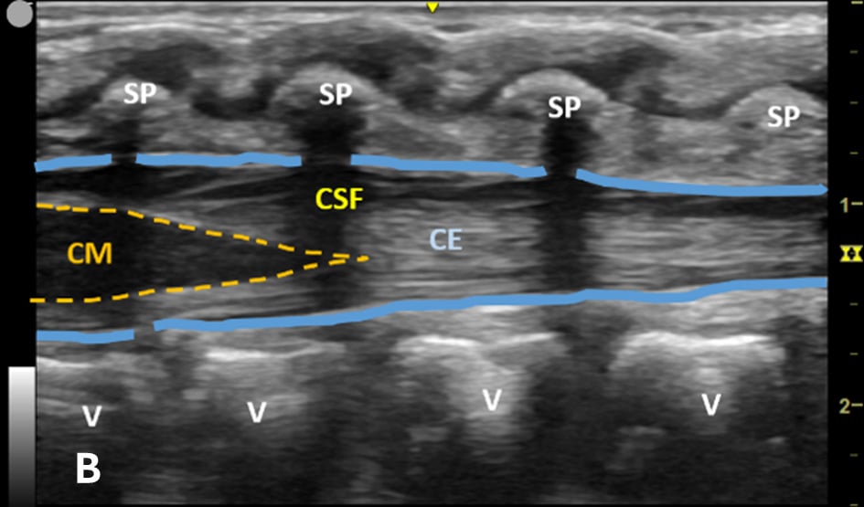 LP Figure 1B.jpg